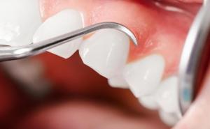 dentist examines the inflamed gengival tissue